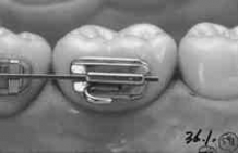 images/productimages/small/30-550SF(cut end1) kopie.jpg
